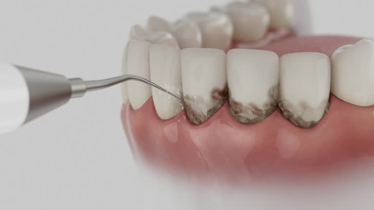 Trusted Root Canal Treatment service in Ronceverte, WV - Dentist Open Now